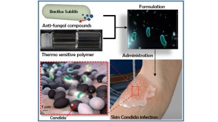 Living Bacteria in Thermoresponsive Gel for Treating Fungal Infections