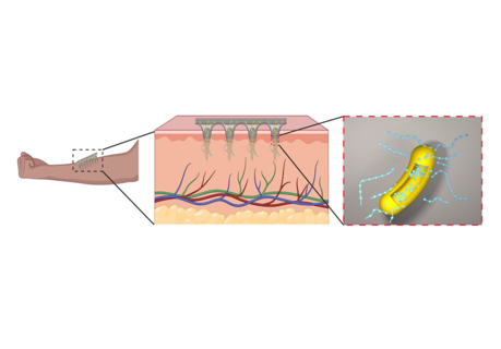Living Materials Approach for In Situ Bio-Polymers Production Using Bacillus Paralicheniformis in Microneedles