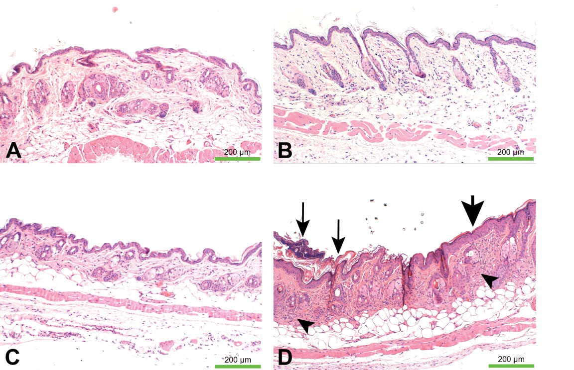 Local Toxicity of Topically Administrated Thermoresponsive Systems: In Vitro Studies with In Vivo Correlation